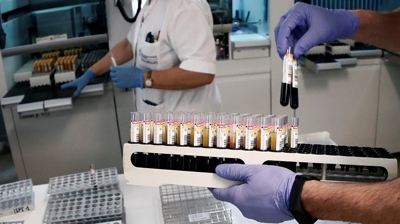 93/10000 Técnicos de laboratorio procesan mostras serolóxicas para a súa posterior análise (EFE/Arquivo)